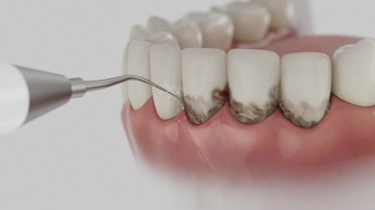 Trusted Invisalign Clear Aligners service in Martinsville, NJ - Dentist Open Now